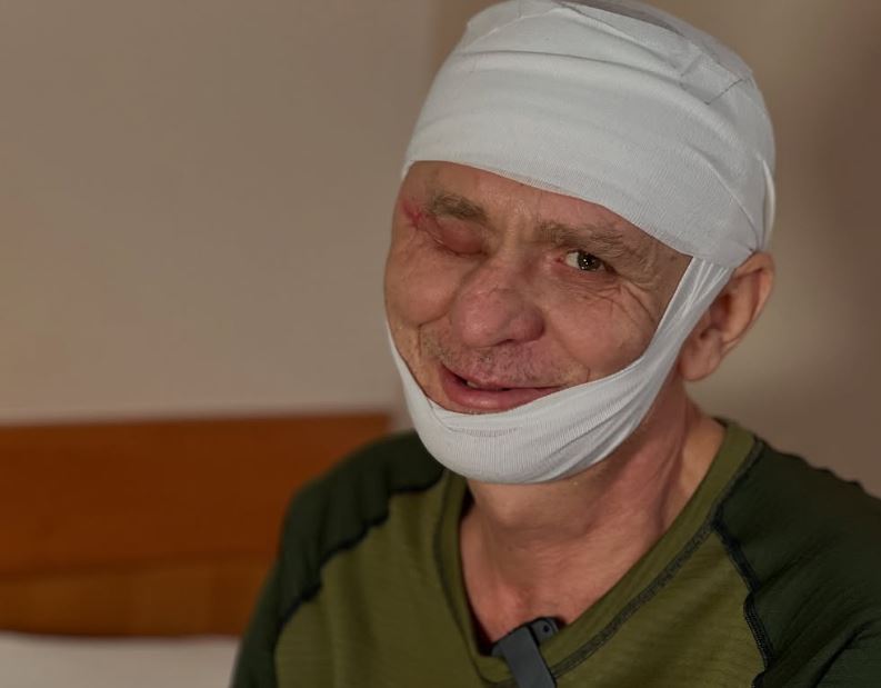 У Харкові провели унікальну операцію з реконструкції обличчя пораненому бійцю. Фото: instagram/shpytal_kharkiv