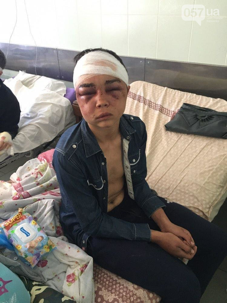 Насиловали и вырывали ногти: мать избитого в Харькове подростка рассказала жуткие подробности фото 1