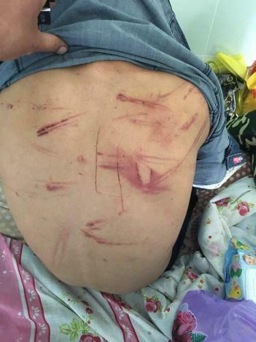 Нашли на остановке: под Харьковом жестоко избили подростка фото 1