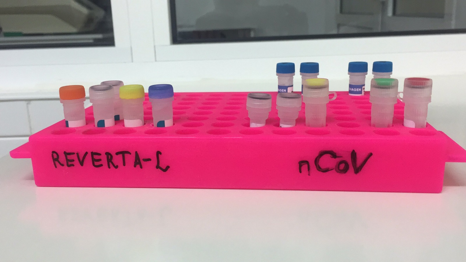 Пришли еще вчера: в областной "инфекционке" появились тесты на коронавирус фото 1