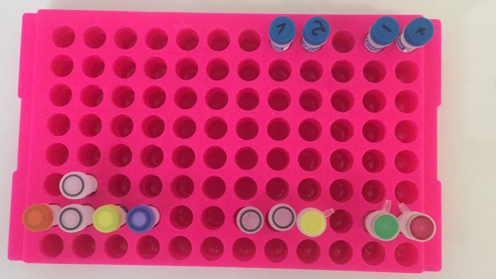 Пришли еще вчера: в областной "инфекционке" появились тесты на коронавирус фото 2 1