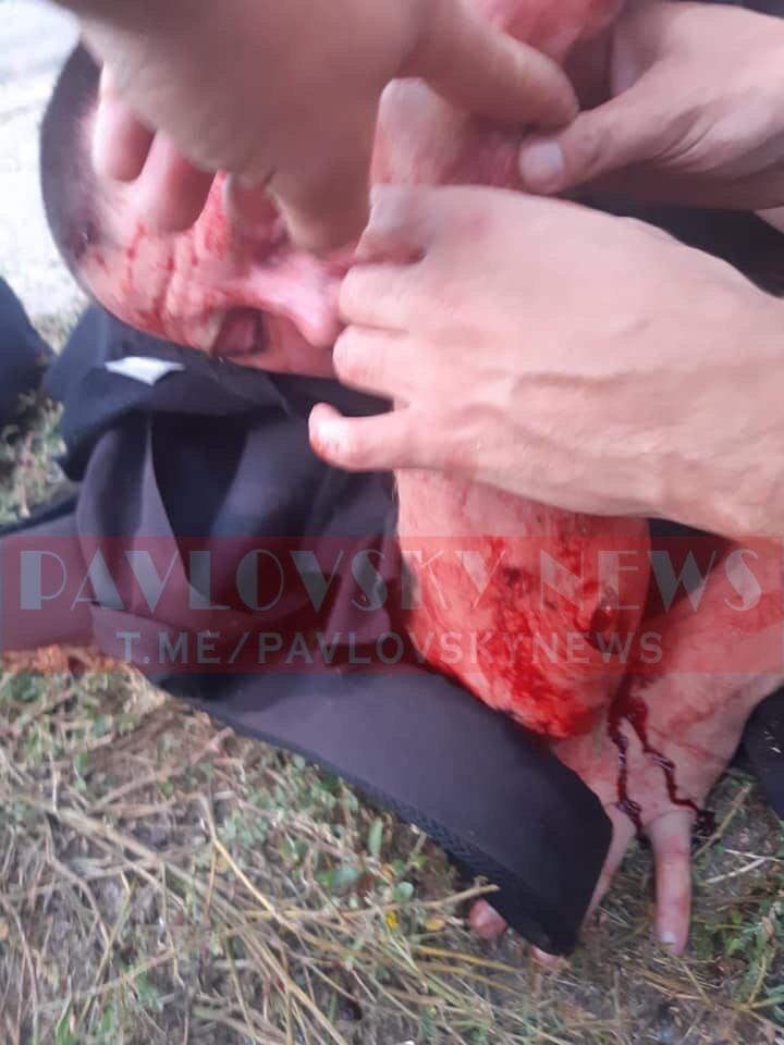 Трое раненых: под Харьковом обстреляли автобус ОПЗЖ (обновляется) фото 1