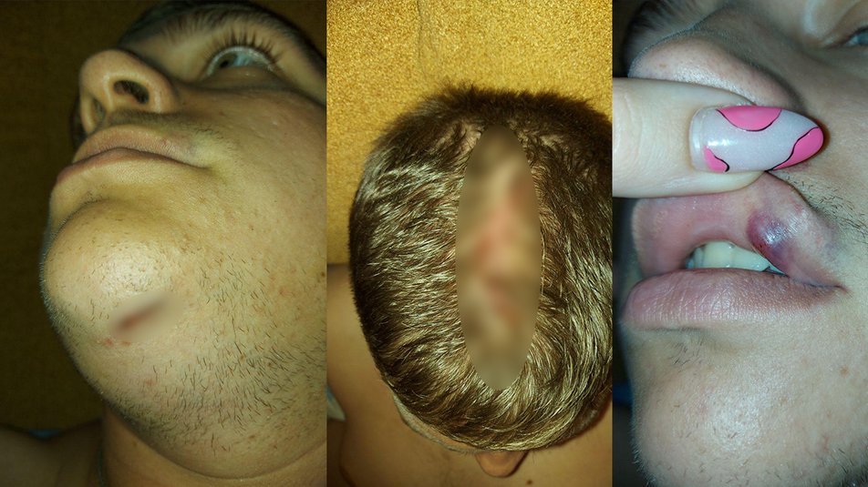 "Девушку ударили ногой в живот, а я выплевывал обломки зубов": харьковский студент обвиняет охрану Сада Шевченко в избиении фото 2 1