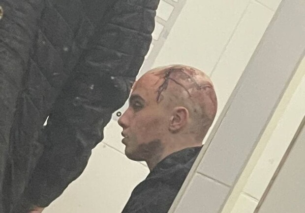 Фото: t.me/kharkiv_1654