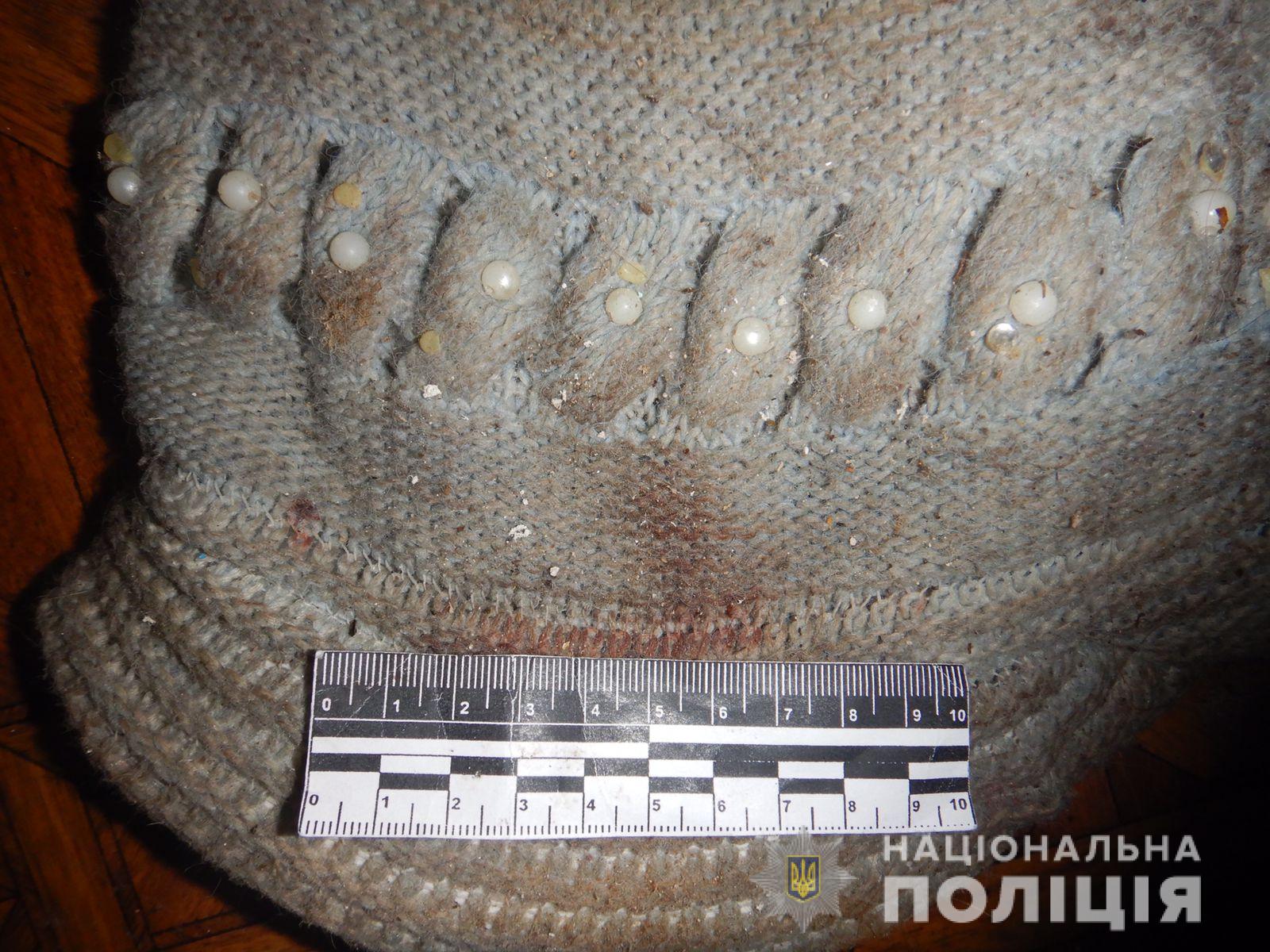 "Изгонял духов": под Харьковом задержан психически больной сын, избивший мать фото 2 1