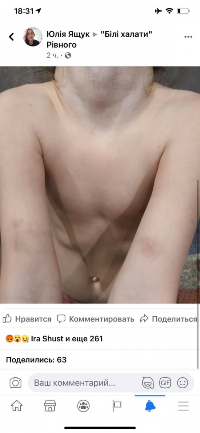 Ребенок после стоматолога.