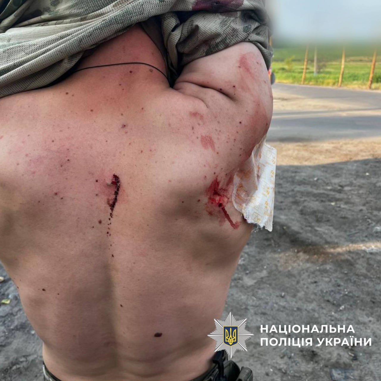 Российский FPV-дрон ударил по автомобилю с полицейскими под Харьковом.