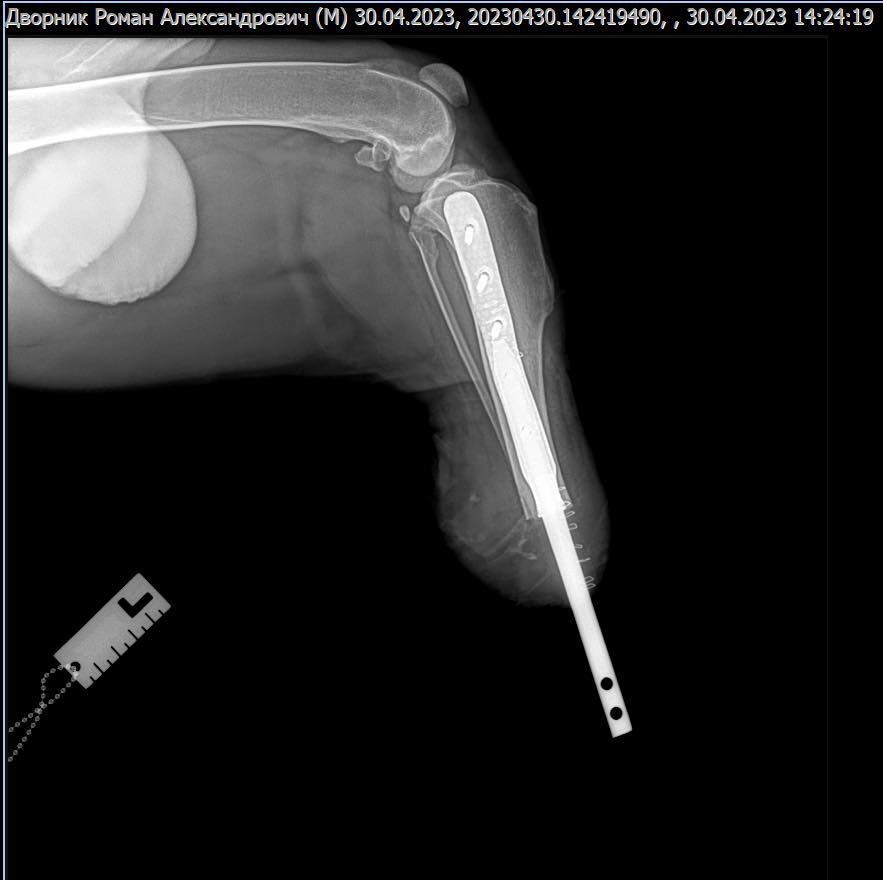 У Харкові пораненому собаці вперше встановили біоінтегрований протез.