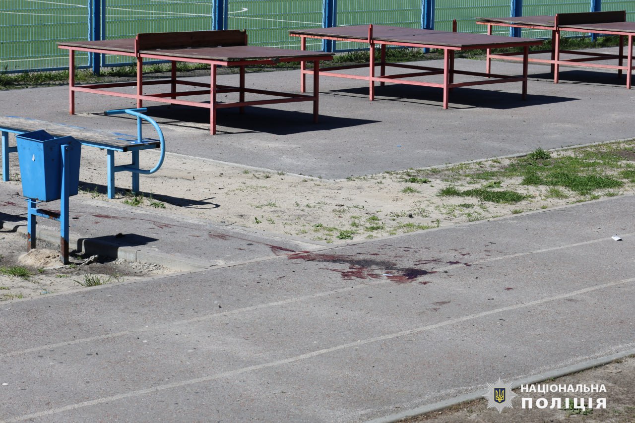 Раненым харьковским подросткам удалось сохранить ноги — СМИ.