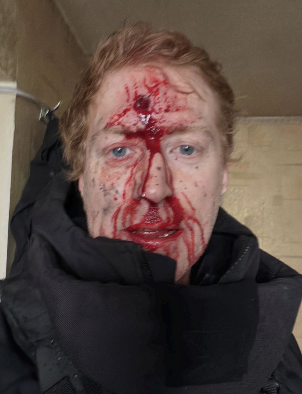 Под Купянском от удара FPV-дрона пострадал волонтер.